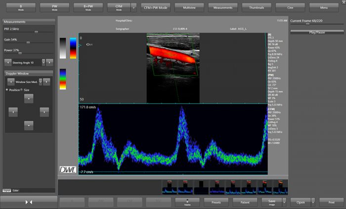 Color Doppler Imaging - DWL